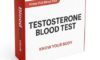 Testosterone Blood Tests: Their Significance in Guildford