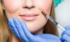 Lip Filler Simulation: Envision Your Ideal Aesthetic!
