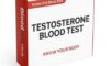 Testosterone Blood Test: Essential Guide for Slough Residents